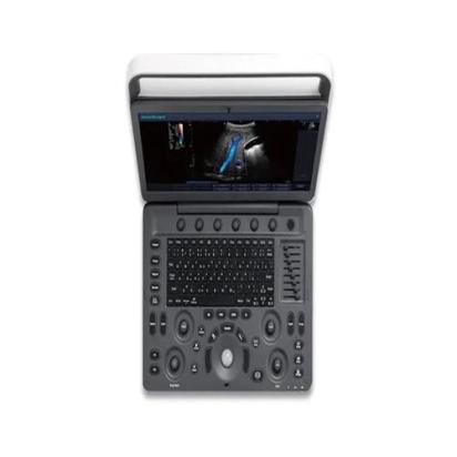 SI Surgical Ultra Sound Machine - E2 by SI Surgical : Colours available: Black